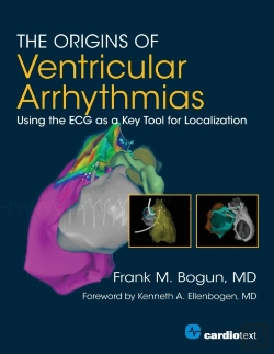 Bertrand.pt - The Origins Of Ventricular Arrhythmias