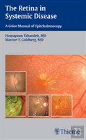 The Retina In Systemic Disease
