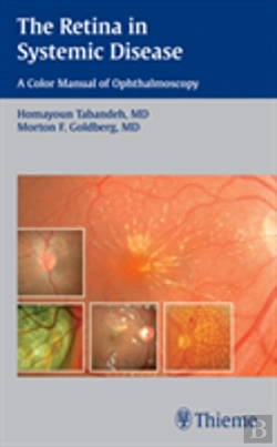 Bertrand.pt - The Retina In Systemic Disease