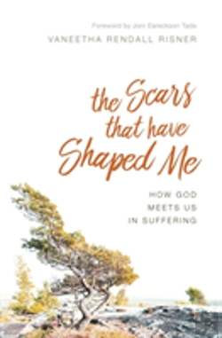 Bertrand.pt - The Scars That Have Shaped Me