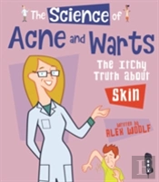 The Science Of Acne & Warts