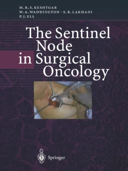 Bertrand.pt - The Sentinel Node In Surgical Oncology