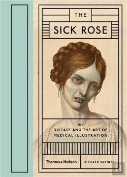 Bertrand.pt - The Sick Rose