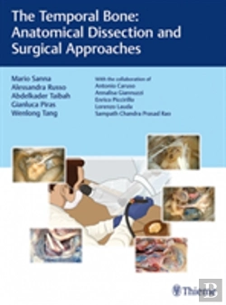 Bertrand.pt - The Temporal Bone