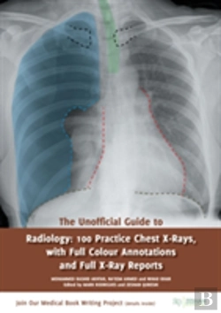Bertrand.pt - The Unofficial Guide To Radiology: 100 Practice Chest X Rays With Full Colour Annotations And Full X Ray Reports