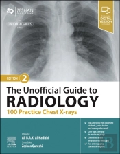 The Unofficial Guide To Radiology: 100 Practice Chest X-Rays