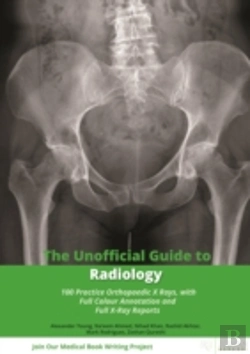 Bertrand.pt - The Unofficial Guide To Radiology: 100 Practice Orthopaedic X Rays With Full Colour Annotations And Full X Ray Reports