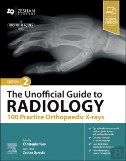 Bertrand.pt - The Unofficial Guide To Radiology: 100 Practice Orthopaedic X-Rays