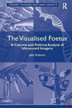 Bertrand.pt - The Visualised Foetus
