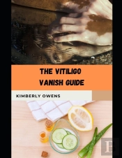 The Vitiligo Vanish Guide