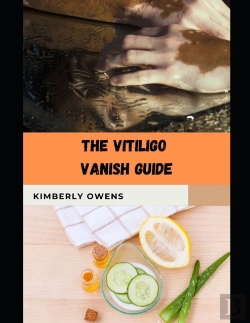 Bertrand.pt - The Vitiligo Vanish Guide