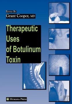 Bertrand.pt - Therapeutic Uses Of Botulinum Toxin