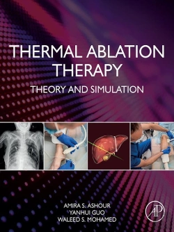 Bertrand.pt - Thermal Ablation Therapy