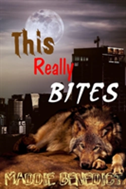 Bertrand.pt - This Really Bites