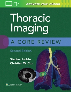 Bertrand.pt - Thoracic Imaging: A Core Review