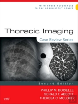 Bertrand.pt - Thoracic Imaging: Case Review Series