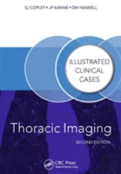 Thoracic Imaging