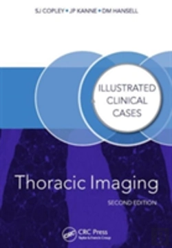 Bertrand.pt - Thoracic Imaging