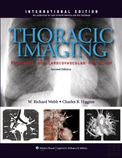 Bertrand.pt - Thoracic Imaging: Pulmonary And Cardiovascular Radiology
