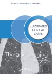 Thoracic Imaging