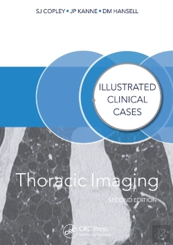Bertrand.pt - Thoracic Imaging