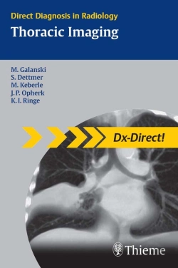 Bertrand.pt - Thoracic Imaging