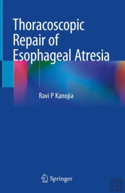 Bertrand.pt - Thoracoscopic Repair Of Esophageal Atresia