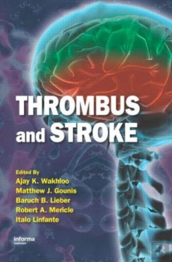 Bertrand.pt - Thrombus And Stroke