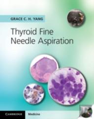 Thyroid Fine Needle Aspiration With Cd Extra
