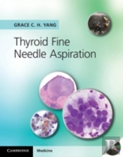 Thyroid Fine Needle Aspiration With Cd Extra