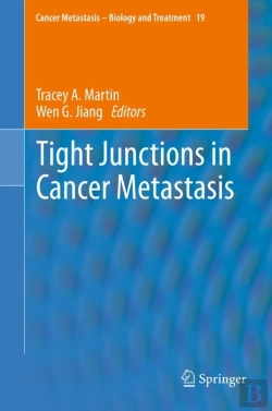 Bertrand.pt - Tight Junctions In Cancer Metastasis