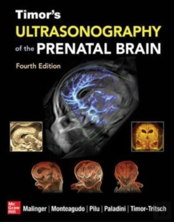 Bertrand.pt - Timor'S Ultrasonography Of The Prenatal Brain, Fourth Edition