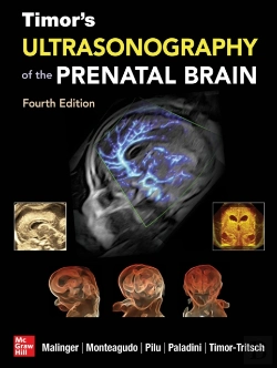 Bertrand.pt - Timor'S Ultrasonography Of The Prenatal Brain, Fourth Edition