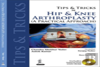 Tips And Tricks In Hip And Knee Arthroplasty
