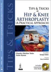 Tips And Tricks In Hip And Knee Arthroplasty
