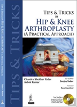 Bertrand.pt - Tips And Tricks In Hip And Knee Arthroplasty
