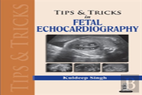 Tips & Tricks In Fetal Echocardiography