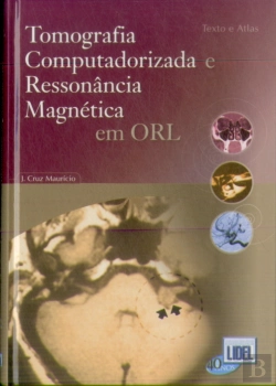 Bertrand.pt - Tomografia Computadorizada e Ressonância Magnética