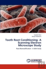 Tooth Root Conditioning- A Scanning Electron Microscope Study