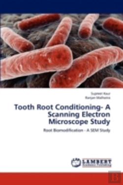 Bertrand.pt - Tooth Root Conditioning- A Scanning Electron Microscope Study
