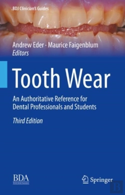Bertrand.pt - Tooth Wear