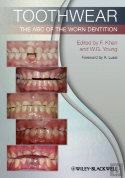 Bertrand.pt - Toothwear