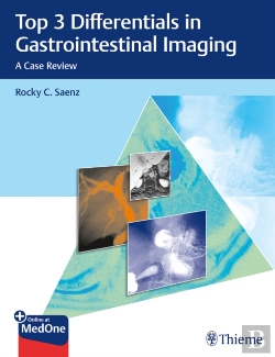 Bertrand.pt - Top 3 Differentials In Gastrointestinal Imaging