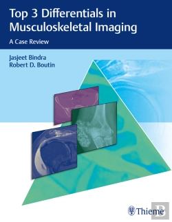 Bertrand.pt - Top 3 Differentials In Musculoskeletal Imaging