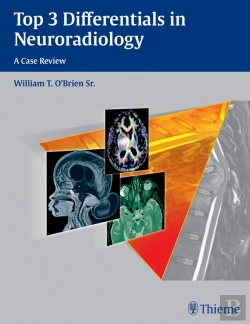 Bertrand.pt - Top 3 Differentials In Neuroradiology