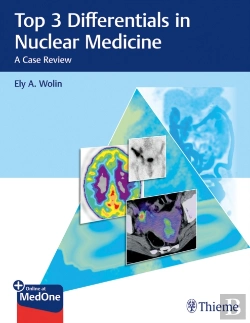 Bertrand.pt - Top 3 Differentials In Nuclear Medicine