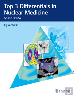 Bertrand.pt - Top 3 Differentials In Nuclear Medicine