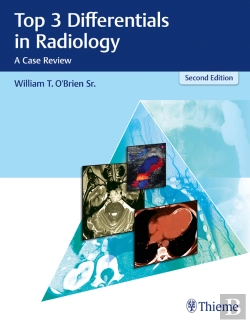 Bertrand.pt - Top 3 Differentials In Radiology