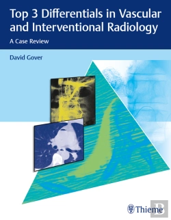 Bertrand.pt - Top 3 Differentials In Vascular And Interventional Radiology
