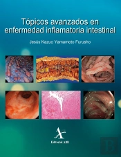 Tópicos Avanzados En Enfermedad Inflamatoria Intestinal